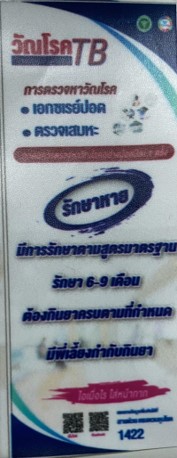 การตรวจหาวัณโรค