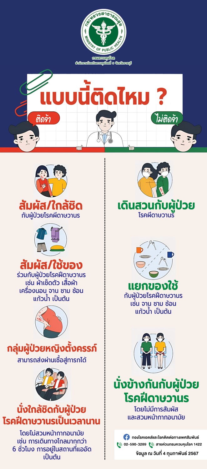 X-Stand Mpox แบบนี้ติดไหม